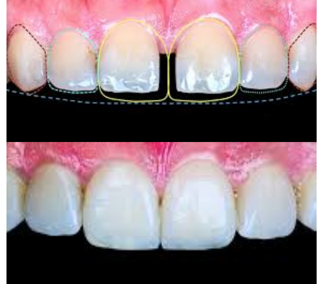 What is the service?