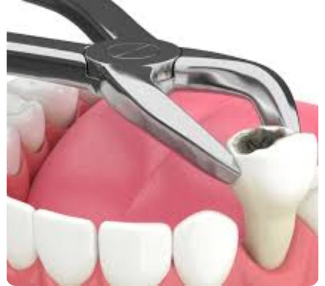 What is the service?