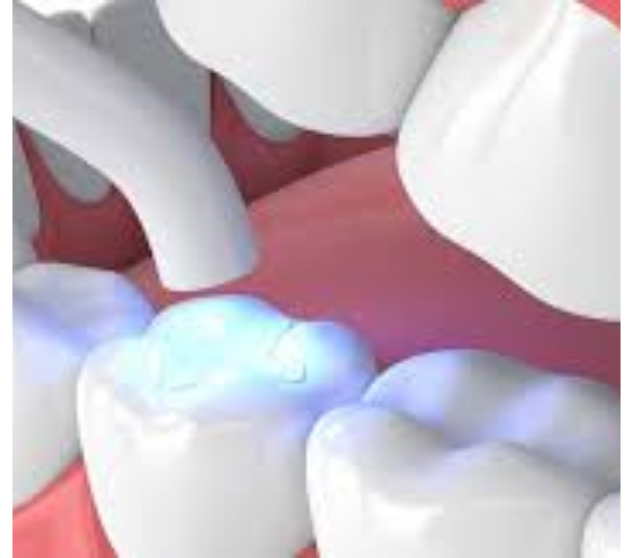 What is the service?