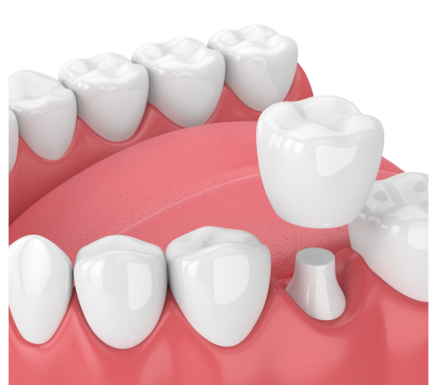 What is the service?