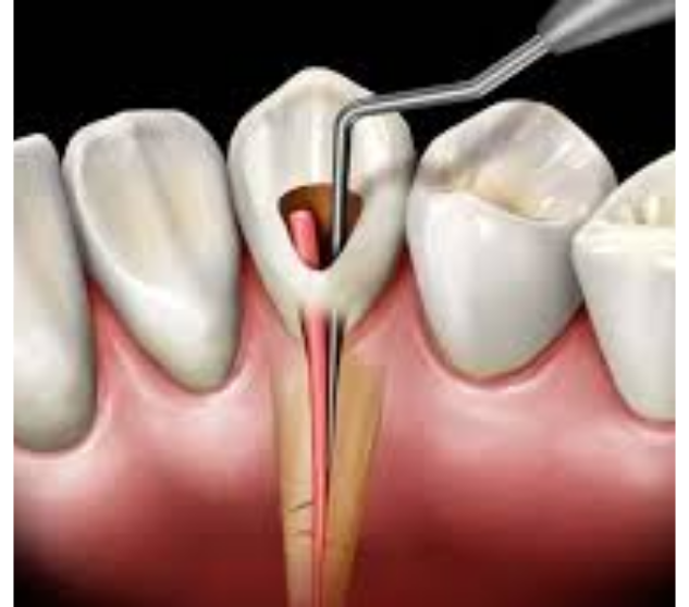 What is the service?