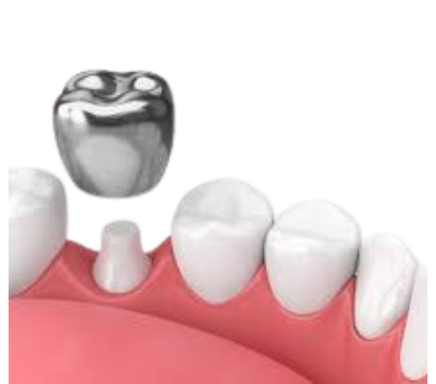 What is the service?